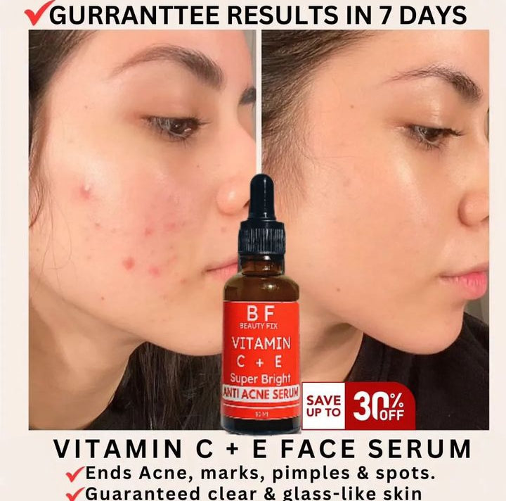 ANTI ACNE BUNDLE